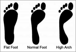 Type Of Feet